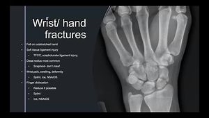 On Field Management of Fractures and Dislocations