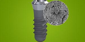 Straumann® SLActive® - Compromised patients