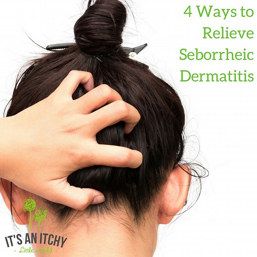 4 Ways to Relieve Seborrheic Dermatitis (Causes & Types Explained Too!)