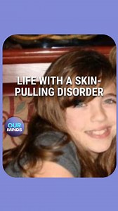 25K views · 207 reactions | She Tried Hypnotherapy For Her Disorder At 8, Maddie started picking at her skin. This habit brought her shame and disappointment. She has dermatillomania, a chronic skin-picking disorder. Hypnotherapy has helped her to manage the condition. | seen.tv | Facebook