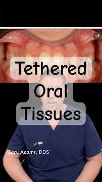Tethered oral tissues and their role in development and orthodontic relapse