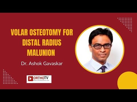Volar osteotomy for distal radius malunion - Dr. Ashok Gavaskar