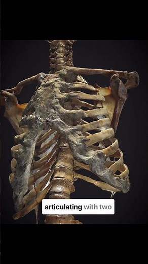 The costovertebral and costotransverse joints! The connections between the ribs and the spine! 🧠