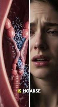 What Happens Inside Your Throat When Laryngitis Strikes