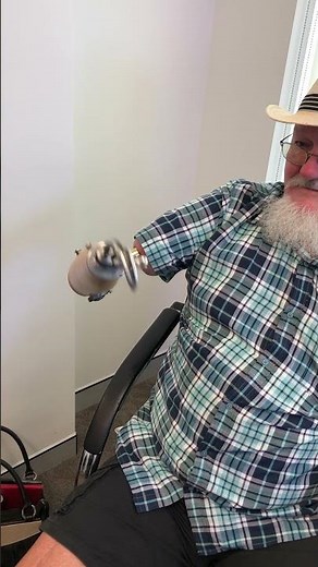 Mechanical arm with Osseointegration for above elbow amputation