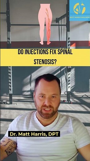 Do injections fix spinal stenosis? #spinalstenosis #spinehealth #backpain