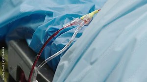 IV tubing or catheter with blood fluid next to blue sheets of patient bed