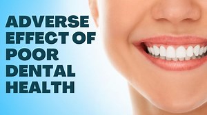 Oral Care Tips: Here's How Poor Dental Health Can Affect Your Overall Well-Being | Watch Video