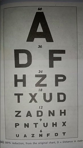 clinical practical physiology visual acuity color vision ischara /snellen's chart / #visualfield