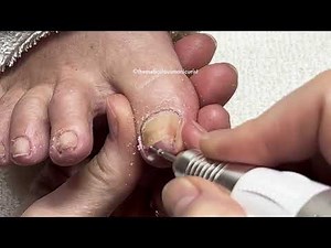 How to Pedicure at Home with Curling Nails