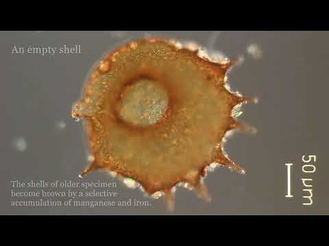 Centropyxis sp., a testate amoeba.