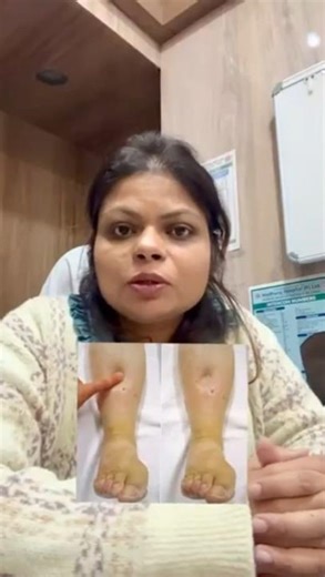 Why Your Feet Are Swollen: Warning Signs You Can't Ignore