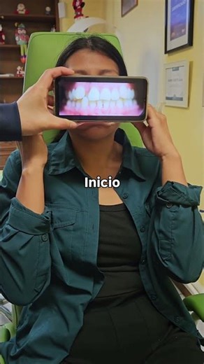 Nuevo casl #ortodoncia #bracket #ortodoncistas #antesydespues #tratamientodeortodoncia #ortodoncista