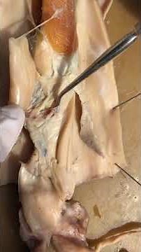 Squid Dissection 6: Female Reproductive and Excretory Systems