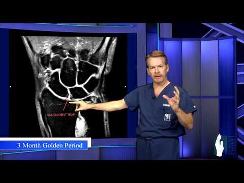 Wrist Ligament Tear Surgery