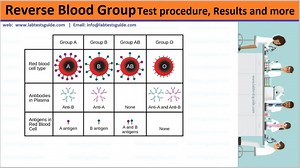 Understanding Reverse Blood Grouping: A Key to Accurate Blood Typing