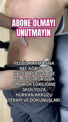 PELVIS EXERCISES. CHIROPRACTIC. WAIST SLIM. HERNIATED DISC EXERCISES. #chiropractic #asmr