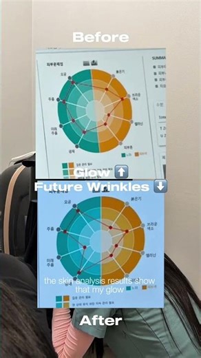 From Skin Age 50 to 50% More Glow #forenaclinic #skincare #koreanskinclinic