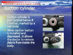 Anatomy of an endoscope endoscopy functions endoscopia funciones