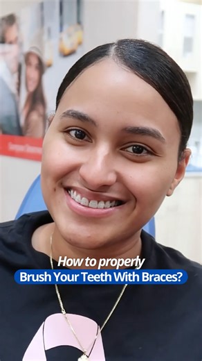 Diamond Braces • Orthodontists on Instagram: "Poor hygiene during treatment risks decalcification (permanent white spots), gingivitis, and cavities around brackets. Your braces are moving teeth through bone remodeling, that requires healthy gums and strong enamel. ⁠ ⁠ The right way: ⁠ ⁠ ✓ 45° angle toward gumline ⁠ ✓ Small circles around each bracket ⁠ ✓ Brush after every meal ⁠ ✓ Floss with threader or Waterpik ⁠ ⁠ Save this if you're considering braces. ⁠ ⁠ #BracesCare #OrthodonticHygiene #Dia