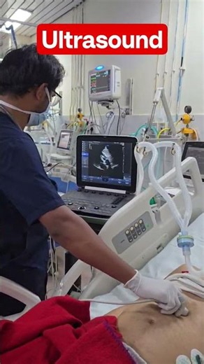 #Ultrasound (USG) Kaise Kiya Jata Hai? | Complete Process##youtubeshorts