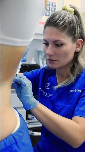 The Belly transformation nobody expected #coolsculpting #beforeandafter