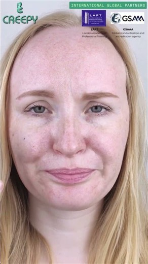 What Causes Pigmentation? | Common Reasons for Dark Spots & Uneven Skin Tone | Skincare Explained
