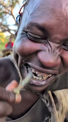 ఈ బూడిదతో దంతాలు శుభ్రం చేసుకోకపోతే!