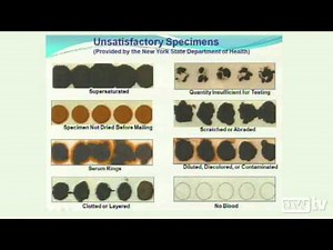 Archive: Blood Spots: Ready for Prime Time?