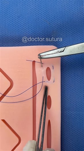 DOCTOR SUTURA on Instagram: "✅Sutura en jareta ✅Sutura en bolsa de tabaco ✅Purse-string suture ✅Sutura de fruncido ✅Sutura circular continua"