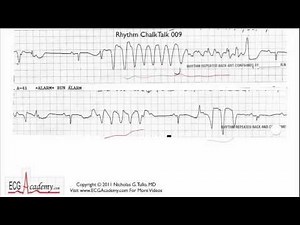 ECG Interpretation, Advanced Level - Part 9 • Video • MEDtube.net