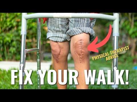 Most People Walk WRONG After Knee Replacement (Fix This)