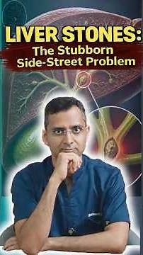 Liver Stones: The Stubborn Side-Street Problems