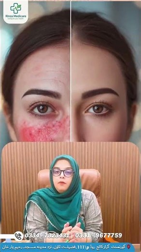 How to Fade Acne Scars Safely | Gentle Exfoliation Tips – Explained by Dr. Sara Shabbir #skincare