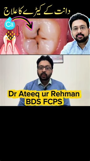 Effective Home Remedies to Prevent Tooth Decay