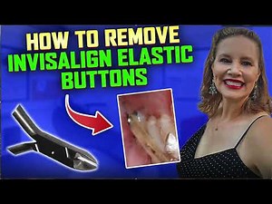How to Remove Elastic Button Invisalign ClearCorrect Rubber Band