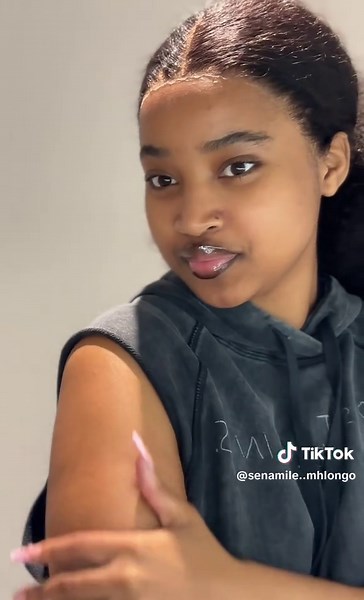 Transform Your Skin with Cellton Tissue Oil for Stretch Marks