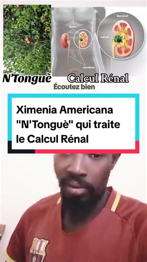 Les vertus de Ximenia Americana en bambara - N'Tonguè pour traiter le Calcul Rénal