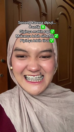 Melting kalo udah dipuji gini 🫣🫠 #beheljourney #underbite #crossbite #orthodontics #behelgigi