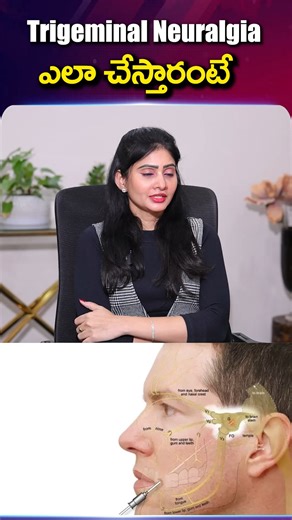 Trigeminal Neuralgia అంటే ఏమిటి Cure Knee Pain/Back Pain/Spine Pain/Neck pain/Shoulder Pain/ Sciatica Pain Without Surgery #PainManagement #NonSurgicalRelief #EpioneHyderabad #BackPainTreatment #KneePainRelief #SpineCareIndia #RegenerativeTherapy #PRPTherapy #PainFreeLiving | Sumantv Money