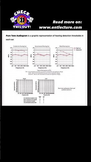 Pure Tone Audiometry | Link in Description | Dr Rahul Bagla Teaching ENT