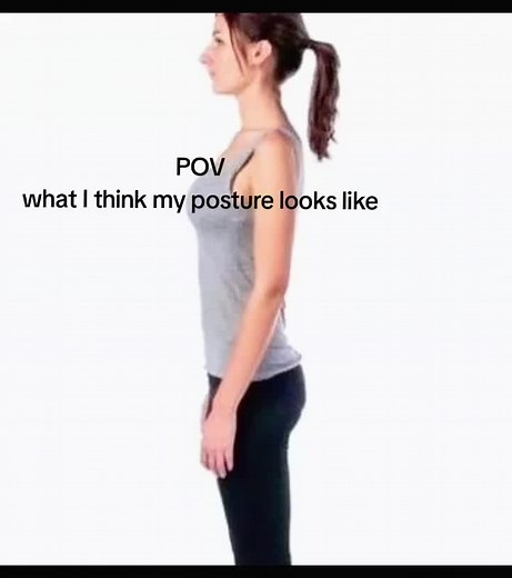 Understanding Scoliosis: Posture Perspectives