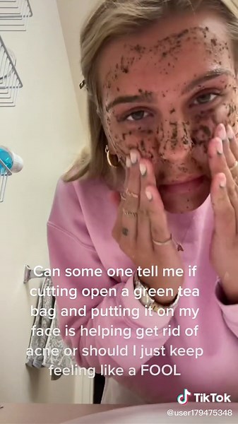 Green Tea Bag Skin Care: Acne Treatment or Foolish Mistake?