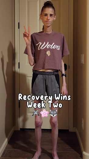 Week Two Recovery Wins. ⚔️🌸🐺 - - - - - #anarecovry #anarecOvery #anarecovey #anrecovery #edrecoovery #edsheeranrecoveryy #fypedrecovery #edrecOvery #edrecov #fearfood #recoveryispossible #recovery #challenge #food #wieiadedrecovery #wieiadrealistic #wieiadrecovery #wieiad #control #breakfree #allin #coldturkey #fyp