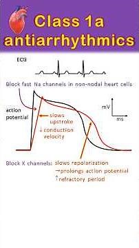 Class 1a antiarrhythmics explained in 60 seconds