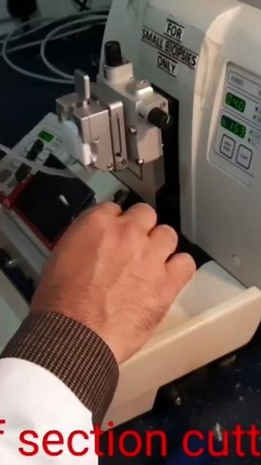 Beauty of biopsy section cutting (Histopathology lab)