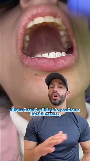 Invisalign and IPR to help straighten teeth, reduce overbites and alter tooth shape.