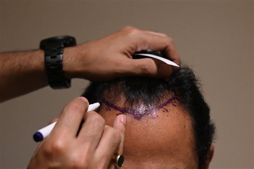Groundbreaking study could rewrite textbooks about how hair grows and spark new treatments
