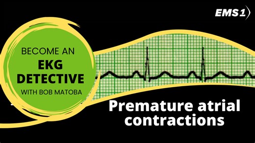 EKG Detective: Premature atrial contractions