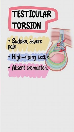 Hydrocele vs Torsion vs Varicocele | USMLE Step 2 Urology High-Yield in 40 Seconds